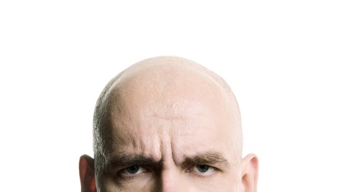 掉頭髮是否為雄性禿  中醫：答案在頭皮厚薄度