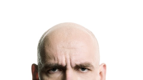 掉頭髮是否為雄性禿  中醫：答案在頭皮厚薄度