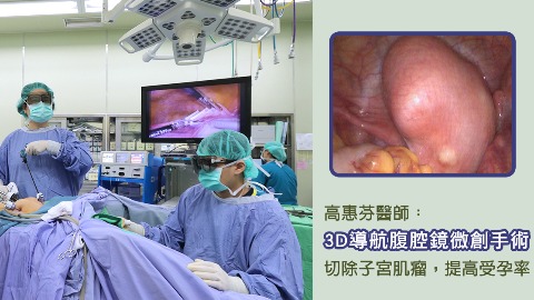 3D導航腹腔鏡微創手術