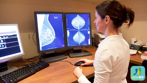 乳房攝影篩檢