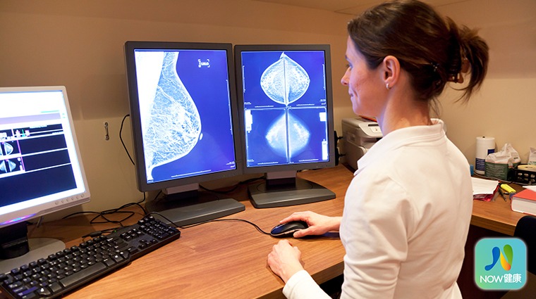 乳房攝影篩檢