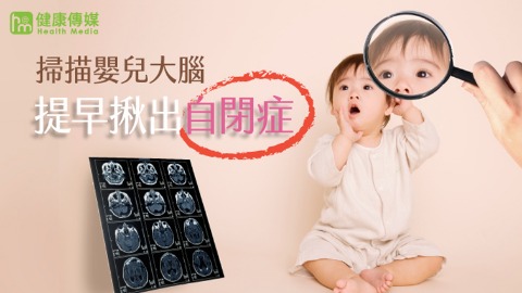 掃描嬰兒大腦 提早揪出自閉症 