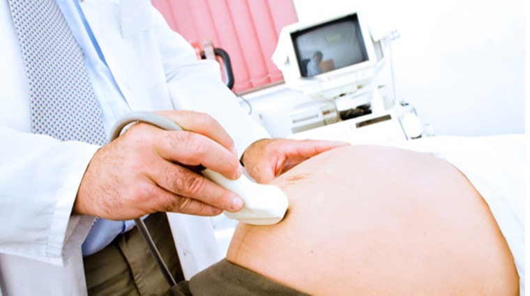 孕婦超音波檢查