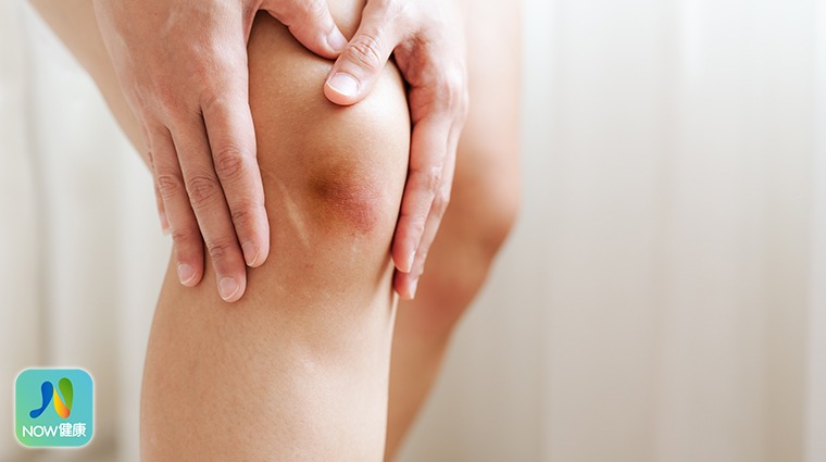 膝盖痛一定是退化性关节炎？ 这6种情况也可能造成