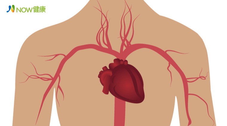 因主動脈剝離驟逝案例頻傳 控制高血壓能避免憾事發生