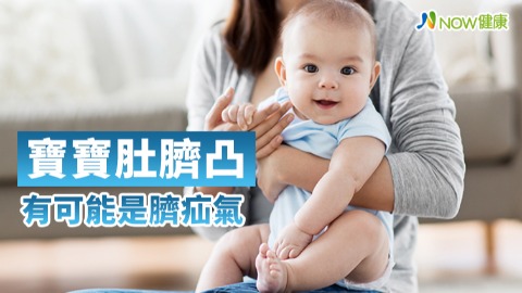 寶寶肚臍凸 有可能是臍疝氣