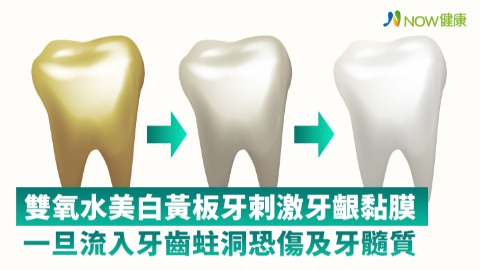 雙氧水美白黃板牙刺激牙齦黏膜 一旦流入牙齒蛀洞恐傷及牙髓質