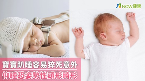 寶寶趴睡容易猝死意外 仰睡恐姿勢性頭形畸形