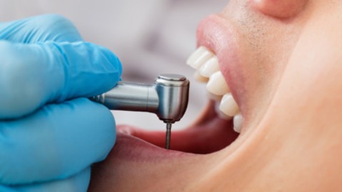 牙齒治療