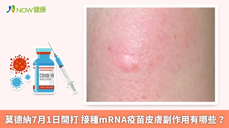 莫德納7月1日開打 接種mRNA疫苗皮膚副作用有哪些？ 
