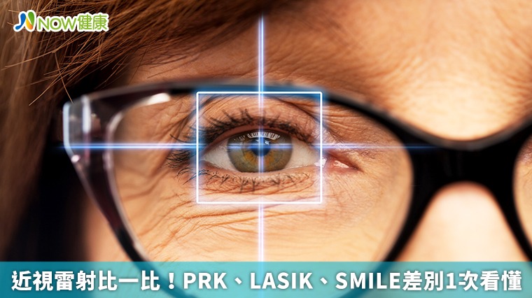 近視雷射比一比！ PRK、LASIK、SMILE差別1次看懂