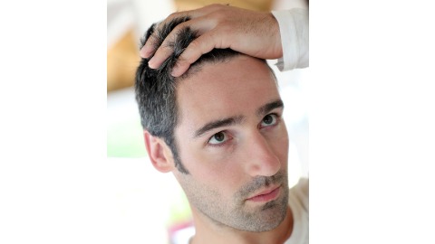 植髮改善圓形禿髮量 根本治療應採免疫調節