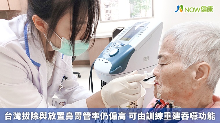台灣拔除與放置鼻胃管率仍偏高 可由訓練重建吞嚥功能