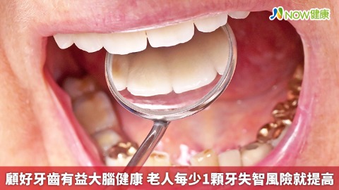 顧好牙齒有益大腦健康 老人每少1顆牙失智風險就提高