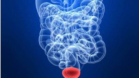 利用小腸再造新膀胱 膀胱癌治療新契機