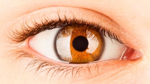 眼睛紅腫可能是前葡萄膜炎  僵直性脊椎炎患者好發