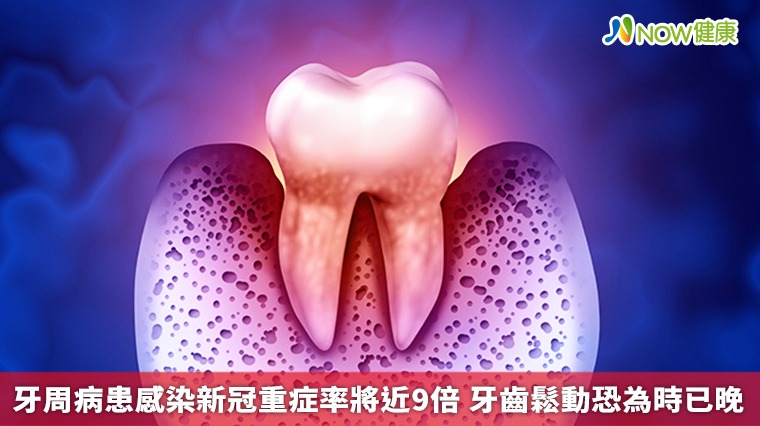牙周病患感染新冠重症率將近9倍 牙齒鬆動恐為時已晚
