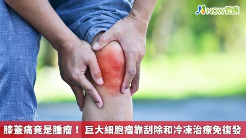 膝蓋痛竟是腫瘤！ 巨大細胞瘤靠刮除和冷凍治療免復發