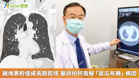 雞塊裹粉造成長期乾咳 醫師扮柯南解「菜瓜布肺」病因