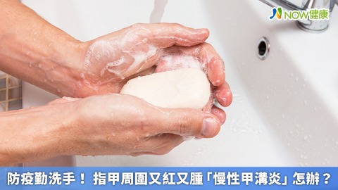 防疫勤洗手！ 指甲周圍又紅又腫「慢性甲溝炎」怎辦？