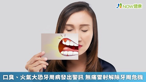 口臭、火氣大恐牙周病發出警訊 無痛雷射解除牙周危機