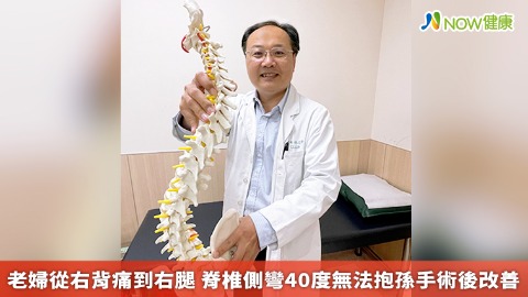 老婦從右背痛到右腿 脊椎側彎40度無法抱孫手術後改善