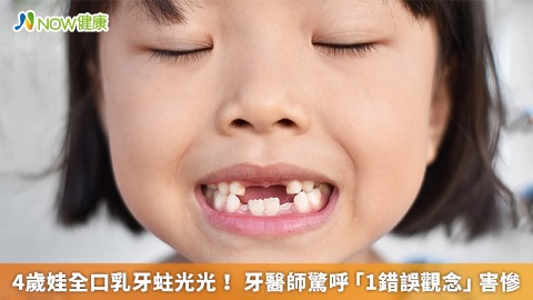 4歲娃全口乳牙蛀光！ 牙醫師驚呼「1錯誤觀念」害慘