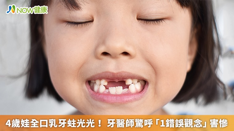 4歲娃全口乳牙蛀光！ 牙醫師驚呼「1錯誤觀念」害慘
