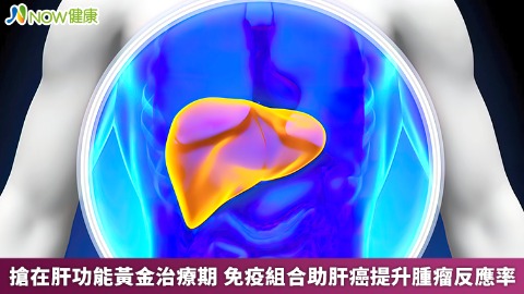 搶在肝功能黃金治療期 免疫組合助肝癌提升腫瘤反應率