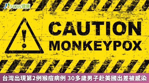 台灣出現第2例猴痘病例 30多歲男子赴美國出差被感染
