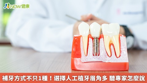 補牙方式不只1種！選擇人工植牙眉角多 聽專家怎麼說