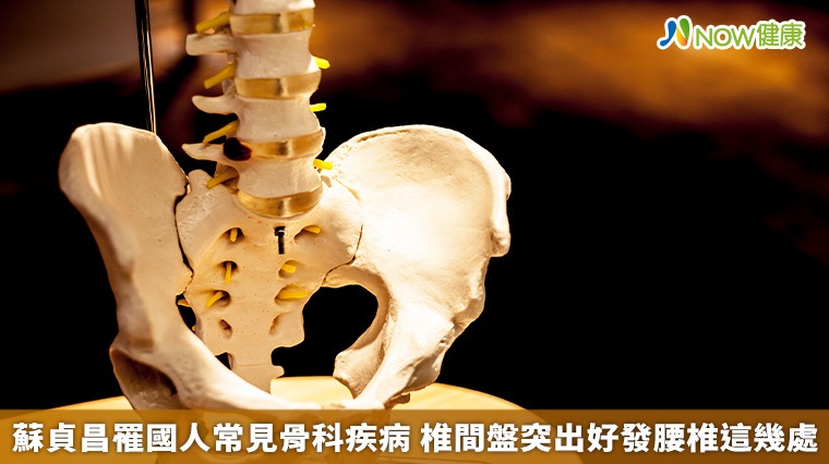 蘇貞昌罹國人常見骨科疾病 椎間盤突出好發腰椎這幾處