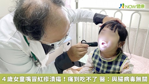４歲女童嘴冒紅疹潰瘍！痛到吃不了　醫：與腸病毒無關