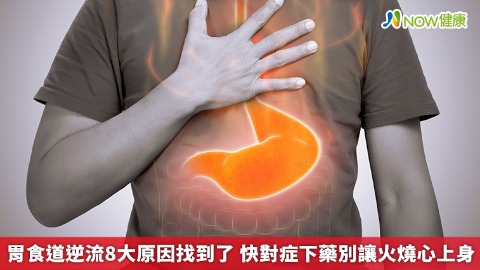 胃食道逆流8大原因找到了 快對症下藥別讓火燒心上身