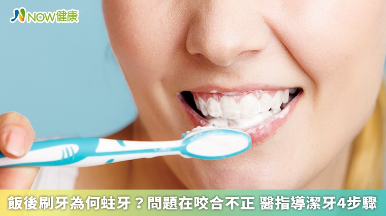飯後刷牙為何蛀牙？問題在咬合不正 醫指導潔牙4步驟