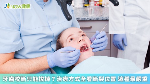 牙齒咬斷只能拔掉？治療方式全看斷裂位置 這種最嚴重