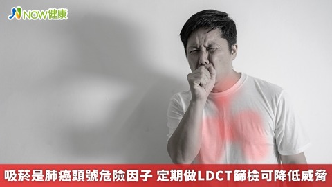 吸菸是肺癌頭號危險因子 定期做LDCT篩檢可降低威脅