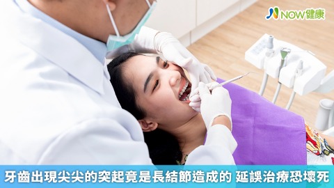 牙齒出現尖尖的突起竟是長結節造成的 延誤治療恐壞死