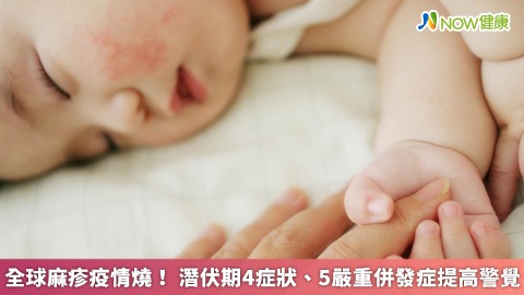 全球麻疹疫情燒！ 潛伏期4症狀、5嚴重併發症提高警覺