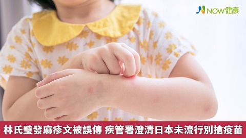 林氏璧發麻疹文被誤傳 疾管署澄清日本未流行別搶疫苗