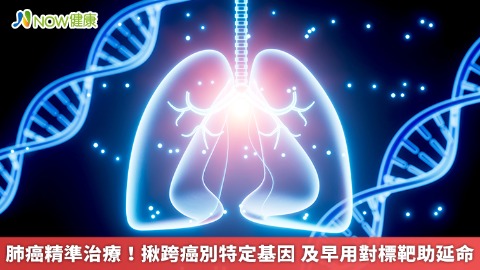 肺癌精準治療！揪跨癌別特定基因 及早用對標靶助延命