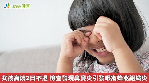 女孩高燒２日不退 檢查發現鼻竇炎引發眼窩蜂窩組織炎　