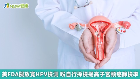 美FDA擬放寬HPV檢測 盼自行採檢提高子宮頸癌篩檢率