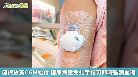 健保放寬CGM給付 糖尿病童免扎手指可即時監測血糖