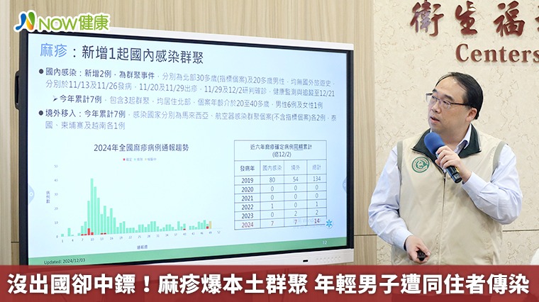 沒出國卻中鏢!麻疹爆本土群聚 年輕男子遭同住者傳染 沒出國卻中鏢!麻疹爆本土群聚 年輕男子遭同住者傳染
