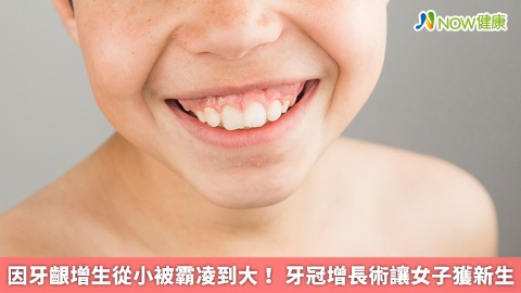 因牙齦增生從小被霸凌到大！ 牙冠增長術讓女子獲新生