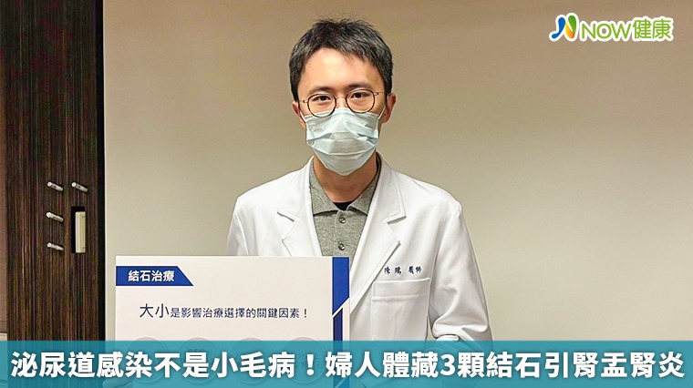 泌尿道感染不是小毛病!婦人體藏3顆結石引腎盂腎炎 泌尿道感染不是小毛病!婦人體藏3顆結石引腎盂腎炎