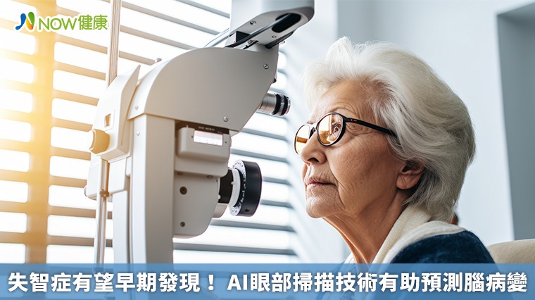 失智症有望早期發現！ AI眼部掃描技術有助預測腦病變