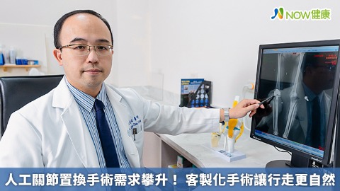 人工關節置換手術需求攀升！ 客製化手術讓行走更自然