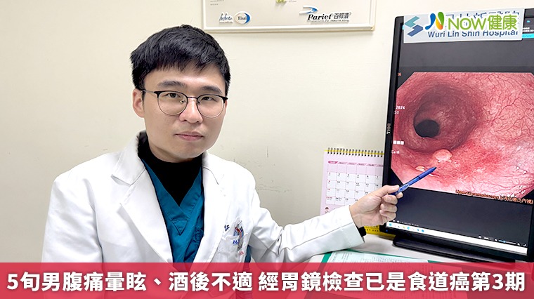 5旬男腹痛暈眩、酒後不適 經胃鏡檢查已是食道癌第3期 5旬男腹痛暈眩、酒後不適 經胃鏡檢查已是食道癌第3期